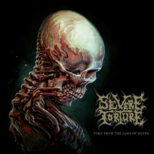 Severe Torture: Torn From The Jaws Of Death - (VINYL LP)